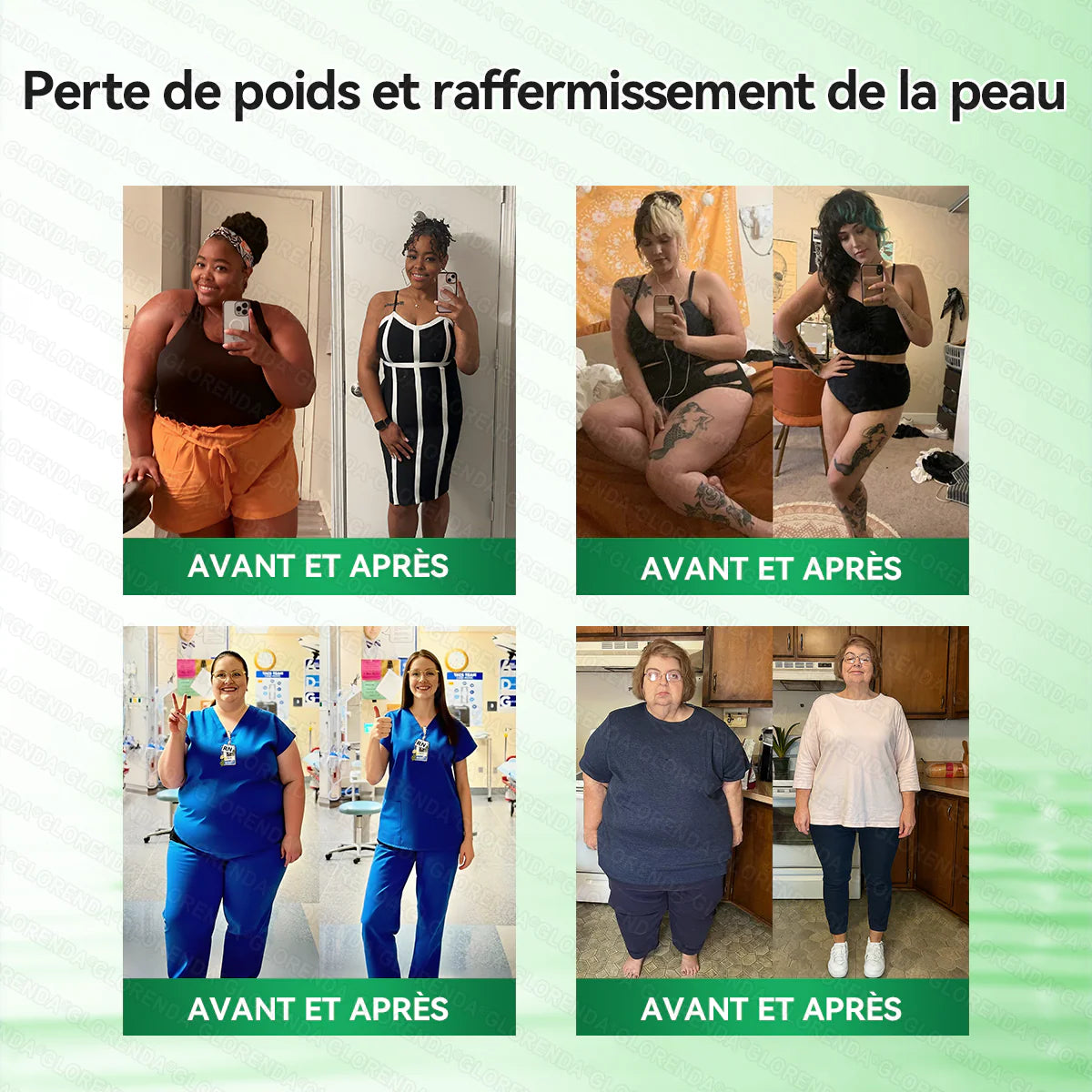 Boutique officielle 🔥🔥 𝐋𝐔𝐗𝐀𝐑𝐈𝐒𝐄® Moringa · Berbérine + NAD+ – Timbre nano à micro‑aiguilles 10‑en‑1 avancé (1× par jour, résultats visibles en 7 jours) | Gestion du poids, relâchement cutané, sommeil, articulations, etc.