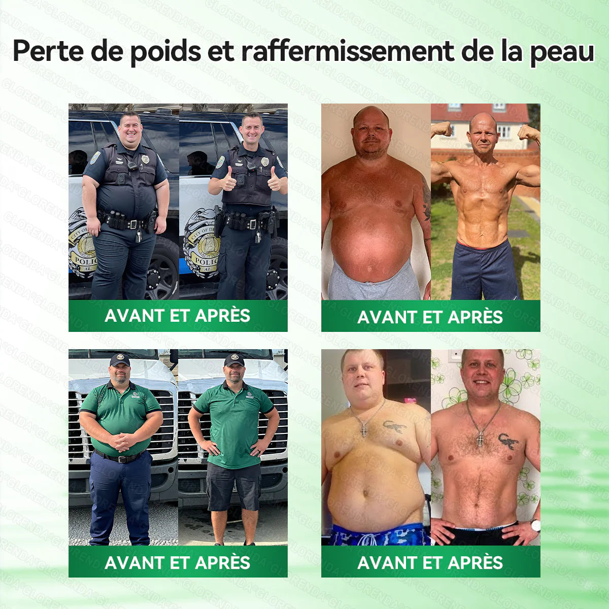 Boutique officielle 🔥🔥 𝐋𝐔𝐗𝐀𝐑𝐈𝐒𝐄® Moringa · Berbérine + NAD+ – Timbre nano à micro‑aiguilles 10‑en‑1 avancé (1× par jour, résultats visibles en 7 jours) | Gestion du poids, relâchement cutané, sommeil, articulations, etc.